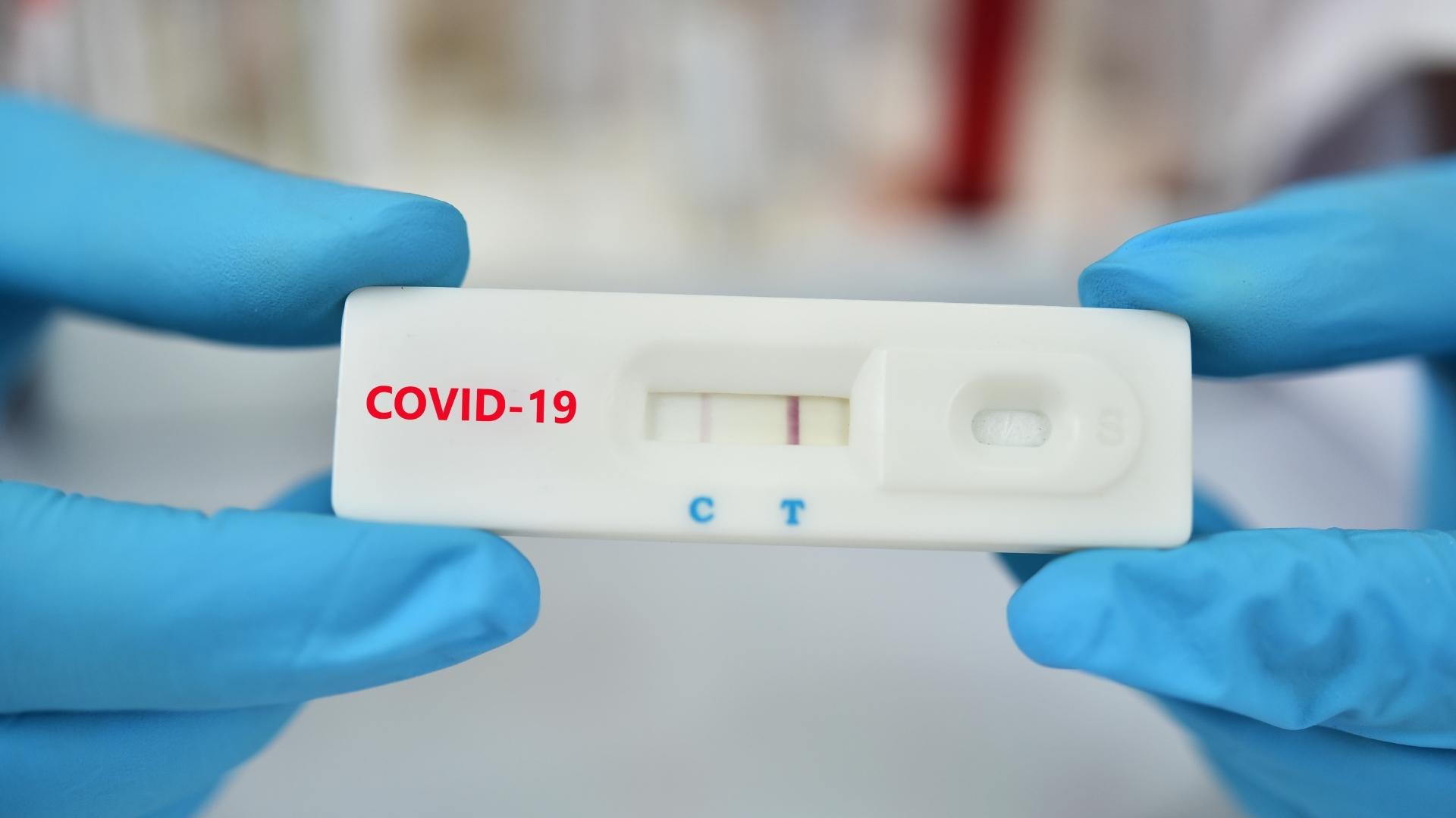 Covid-19: SNS24 prescreve teste antigénio automaticamente em caso de autoteste positivo